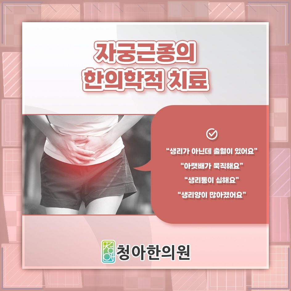 자궁근종의 비수술적 관리 방법과 고려할 점
